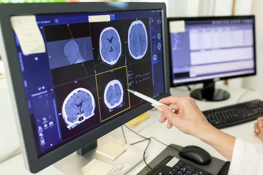 Human brain scans